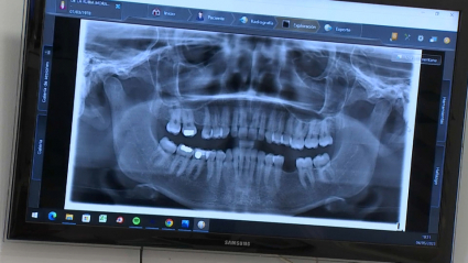 Radiografía en una clínica dental.