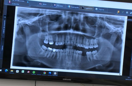 Radiografía en una clínica dental.